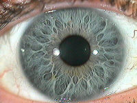 20060919173309-gland.jpg