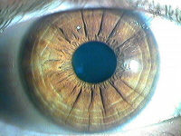 20060919174825-radials.jpg