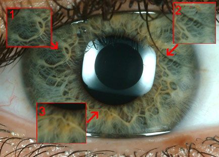 20070609155639-iris-iridologia.jpg